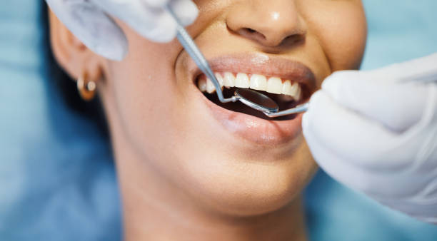 Best Emergency Dental Care for Broken or Chipped Teeth in Brookside, NJ